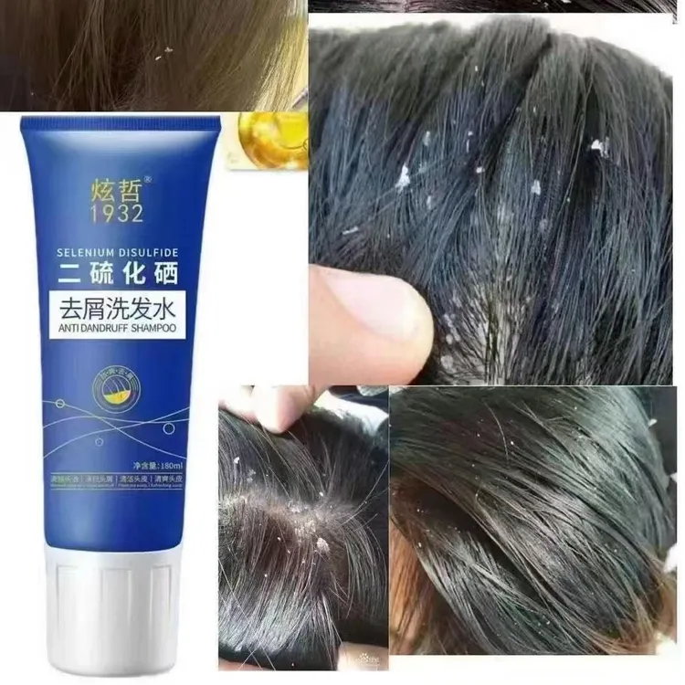 炫哲/二硫化硒去屑洗发水