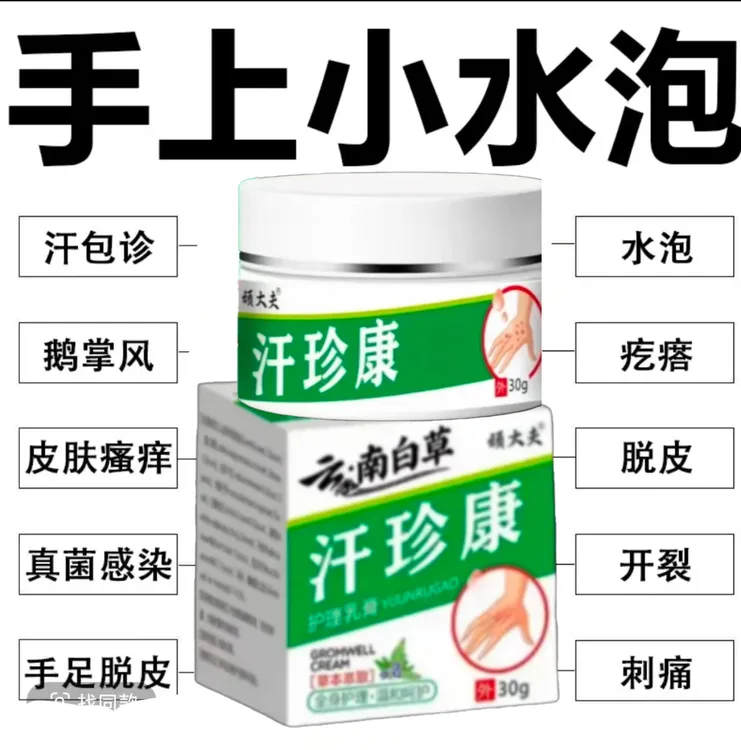 汗泡诊专用手上起小水泡止痒膏脱皮手指缝痒干裂专用草本