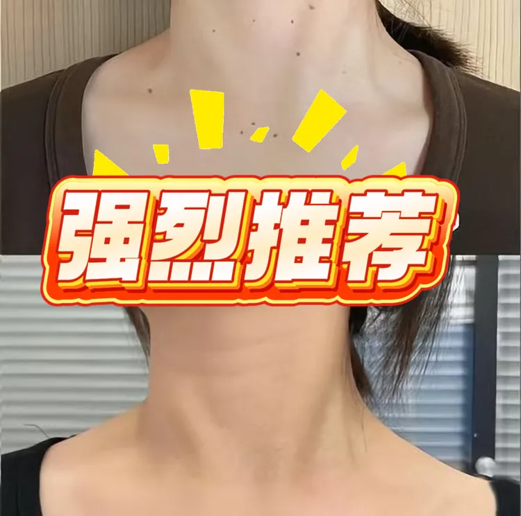 H-P-V咪·奎·乳·膏·软·膏 