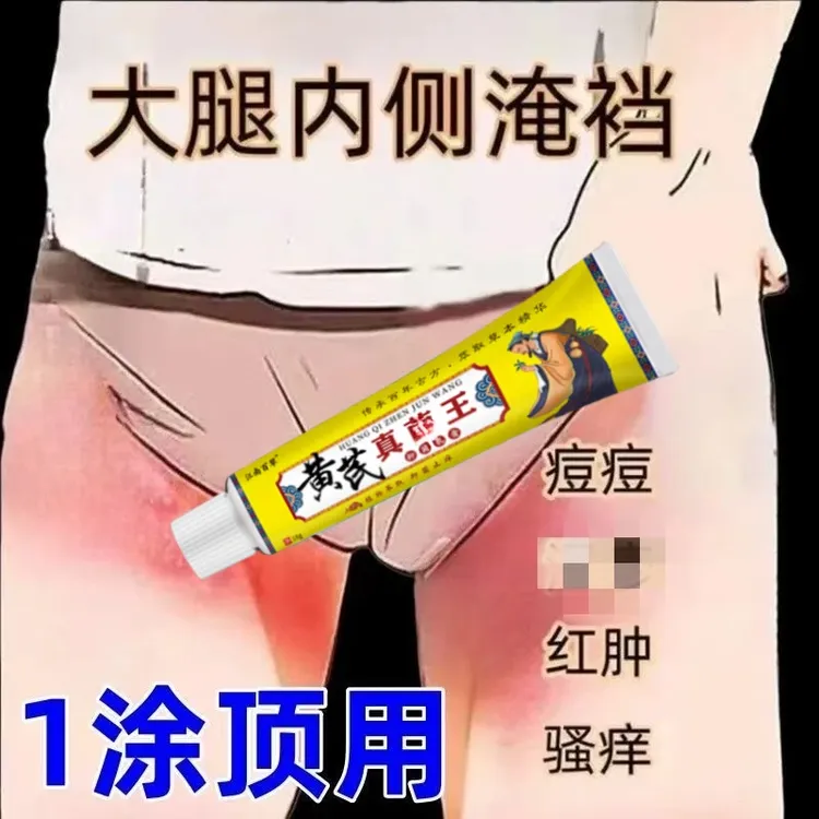 大腿内侧瘙痒越抓越痒大腿和睾丸夹缝处潮湿异味外用止痒抑菌乳膏