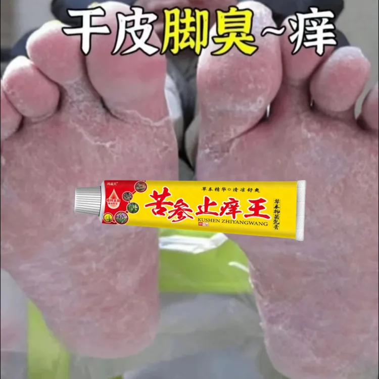脚痒专用抑菌止痒膏脚臭气干裂脱皮汗脚趾缝痒喷剂修复克星起水泡