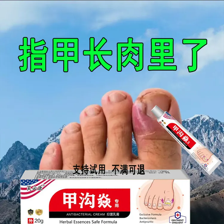  指甲长肉里脚趾脓嵌甲肉芽脚指头疼甲沟膏