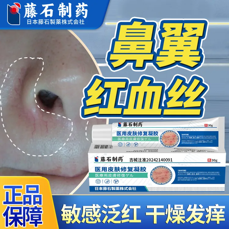 藤石制药医用皮肤修复凝胶脂溢性皮炎鼻翼两侧发红瘙痒敏感qu