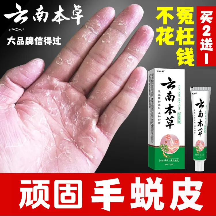 云南本草手足脱皮膏草本精粹外用手脚部脱皮干裂抑菌止痒干软膏