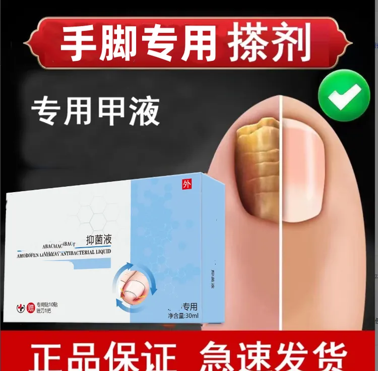 【官方正品】手指脚指发黄发灰增厚叠层渗透抑菌剂草本萃取外用