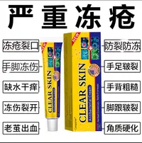 冻仓膏消肿止痒耳手脚护手霜防冻防裂皲裂脚裂开裂膏草本外用