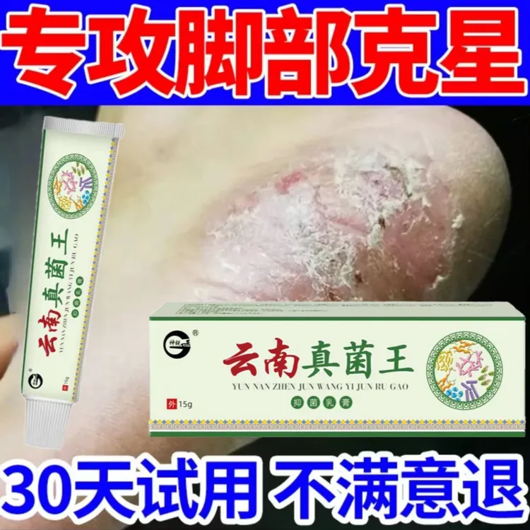 《云南真菌王》脚起皮脚脱皮修复膏脚后跟开裂皲裂防裂止痒膏