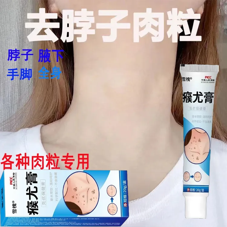 雪槐瘊尤膏20g【正品】草本克尤膏扁平赘尤肉刺瘊子肉粒瘊尤膏