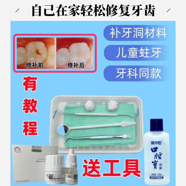 补牙齿洞补牙缝  自己在家修复牙齿粘合剂  补牙神器自己在家补