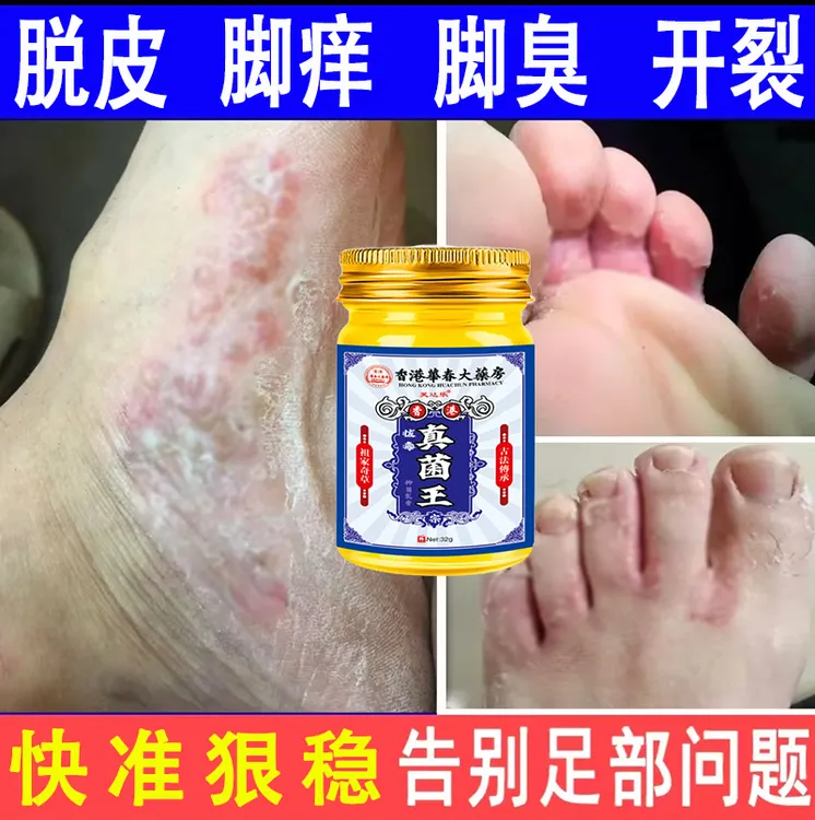 【真菌王】正品保障足部护理草本植物精华萃取清凉舒适外用云南本草