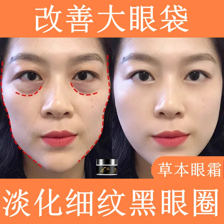 改善细纹黑眼圈男女士眼部精华油草本眼霜提拉紧致眼袋消除神器