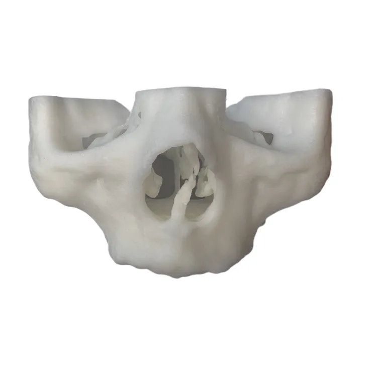 解剖模型 口腔模型 穿颧 穿翼