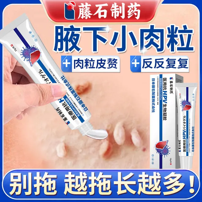 藤石制药腋下丝状疣腋下丝状疣肉粒膏腋下丝状小肉条腋下长丝状疣医用抗HPV生物凝胶N3
