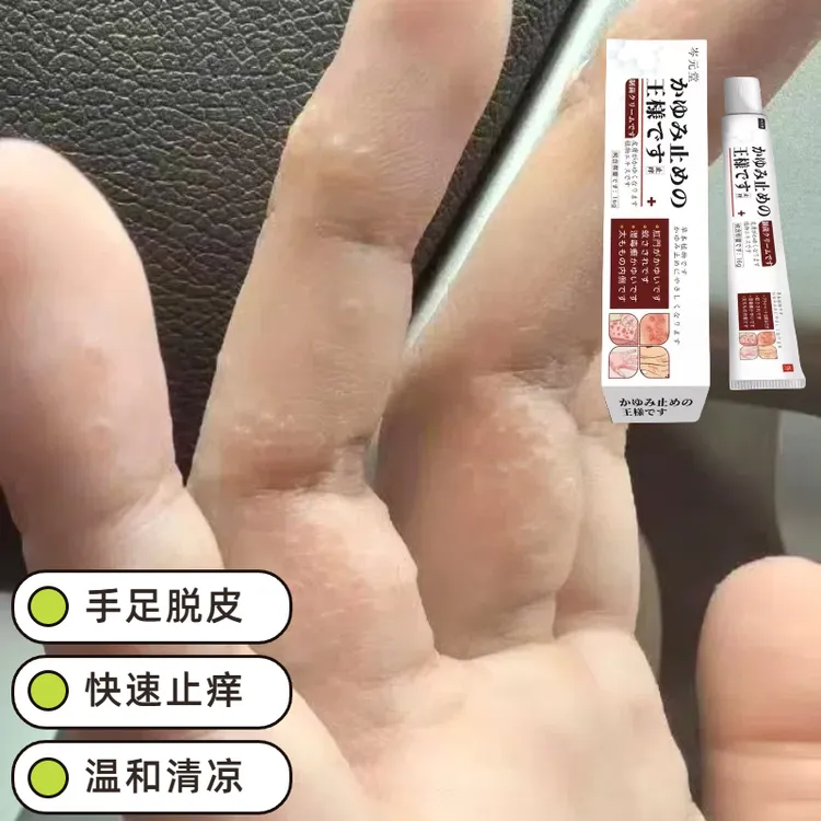  日本止痒王皮肤抑菌膏草本精华萃取乳膏平替好物