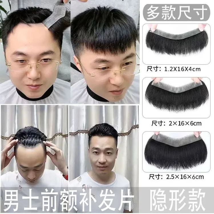 发际线男士前额隐形无痕男补发片真发隐形生物头皮M型额头刘海片