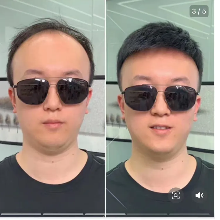 每一顶假发都是定制 不卖通货和假货 主播10年现场经验 亲自设计