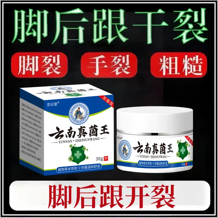 正品云南真菌王脚后跟起皮粗糙干裂起硬皮手开口干裂防裂膏