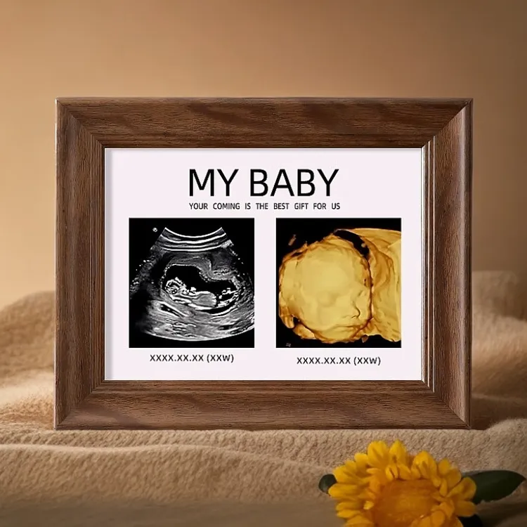 四维照片相框摆台孕期NT产检24周婴儿彩超照打印装裱定制出生礼物