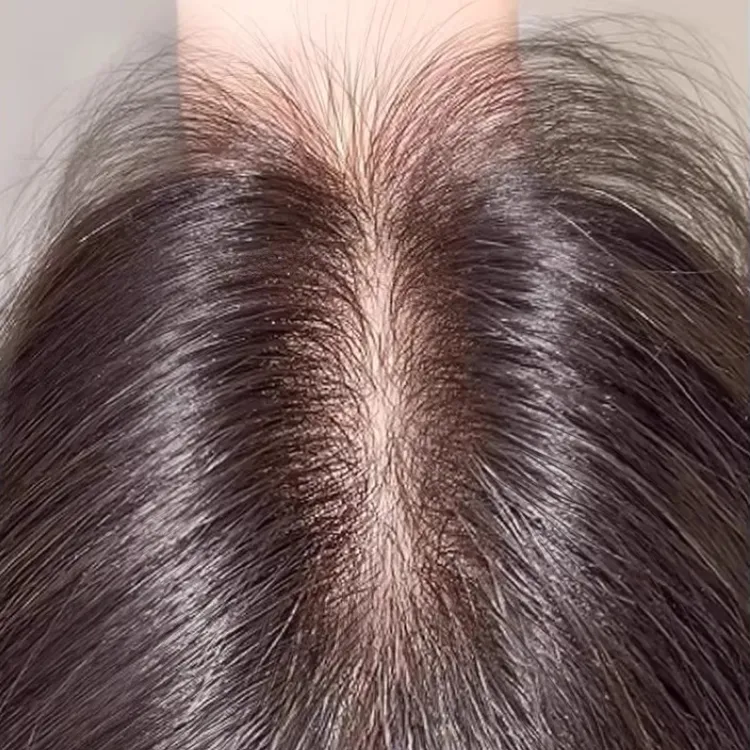 全手织瑞士网递真全真发假发头顶遮白发蓬松高颅顶轻薄无痕假发片