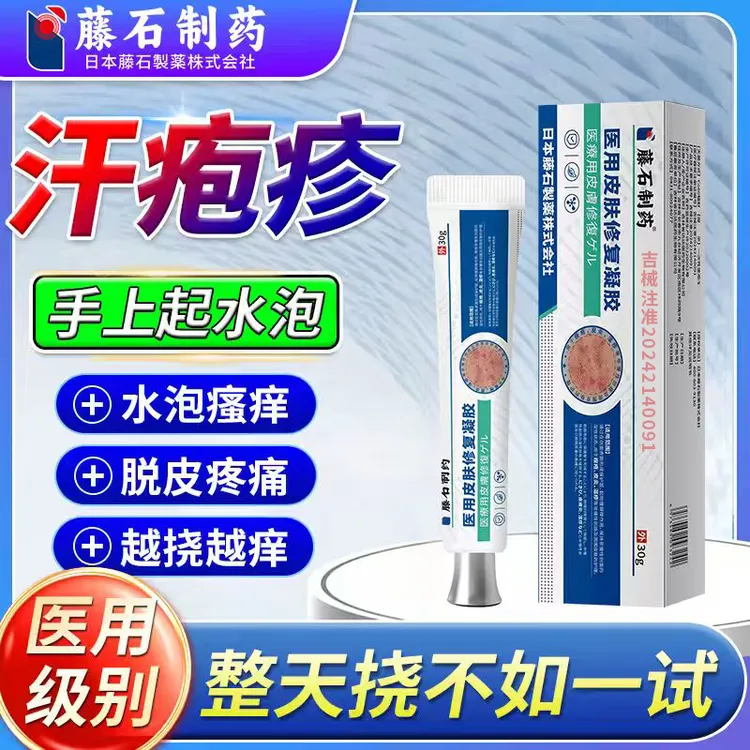 藤石制药汗疱疹手上长小水泡汗状疱疹手指起止脱皮痒手气感染儿童成人kh医用皮肤修复凝胶