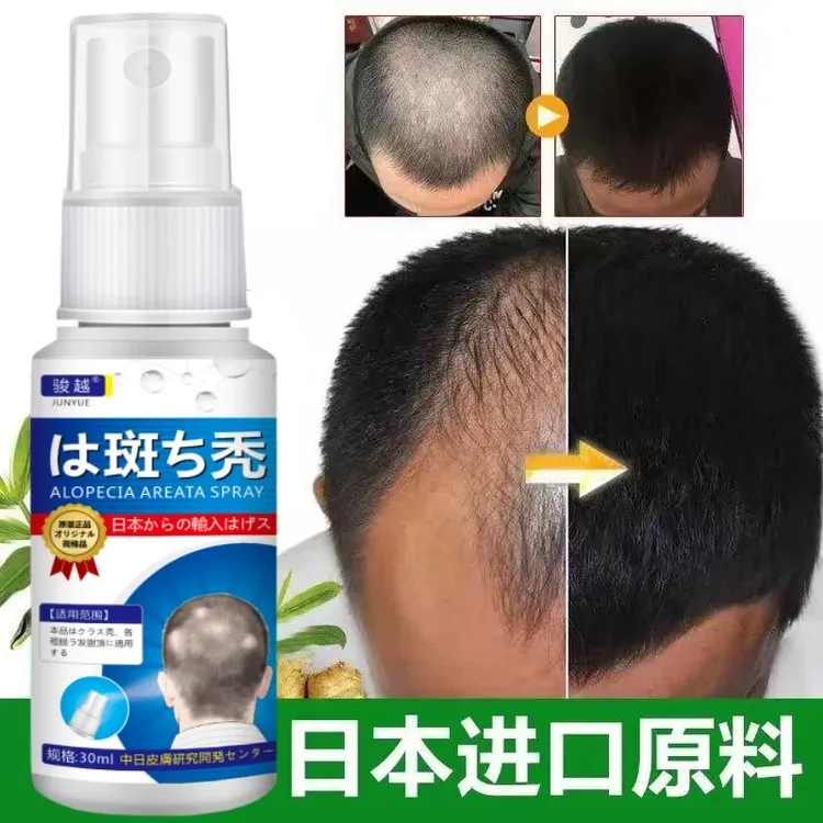 斑秃鬼剃头生发液严重掉发秃顶突发性斑秃非瘢痕性突发成片脱发