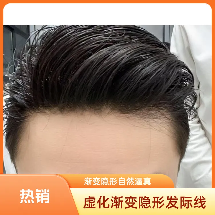 渐变虚化《美人尖》超薄隐形发际线递针工艺仿真头皮男士假发