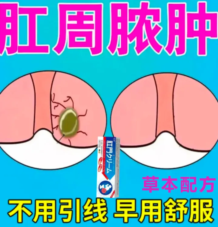 肛瘘肛周脓肿软膏肛周经常疼痛肛瘘硬块外口流脓外用草本膏
