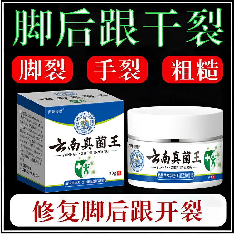 云南真菌王脚后跟起皮粗糙干裂起硬皮手开口干裂防裂手足护理膏
