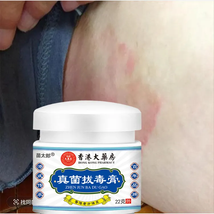【热销】香港真菌拔毒膏有效止痒皮肤干燥红痒外用全身干痒止痒膏
