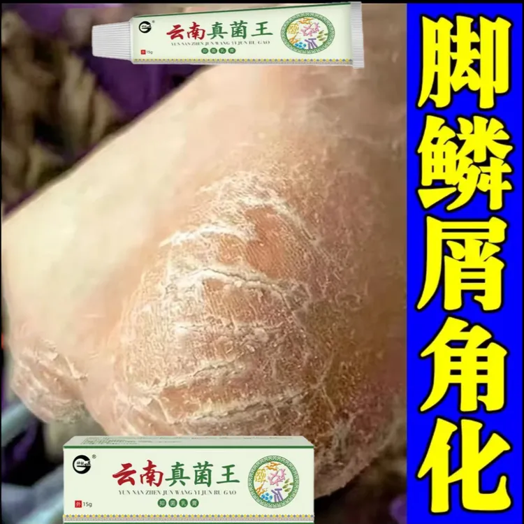 云南真菌王脚起皮脚脱皮修复膏脚后跟开裂皲裂防裂止痒膏