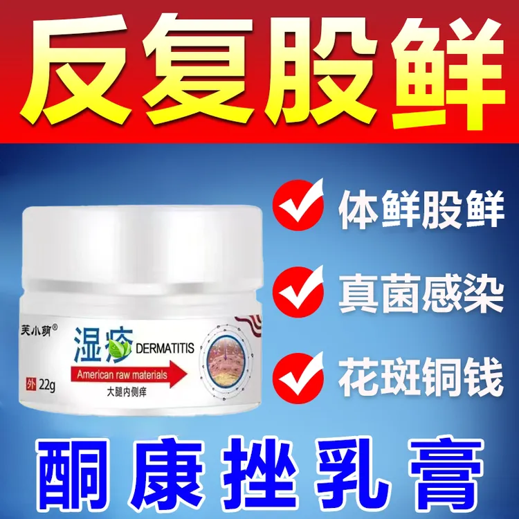 酮康唑2%*22g手鲜 足鲜 体鲜 股鲜  花斑鲜