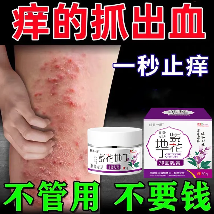 【官方正品】紫花地丁断痒膏大腿内侧痒全身皮肤红痒快速止痒地肤子