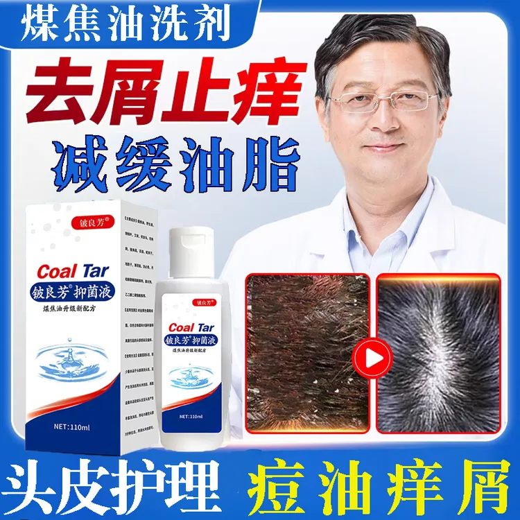 【止痒去屑】煤焦油洗剂去屑止痒洗发水凉爽头皮痘脂溢性抑护洗发液