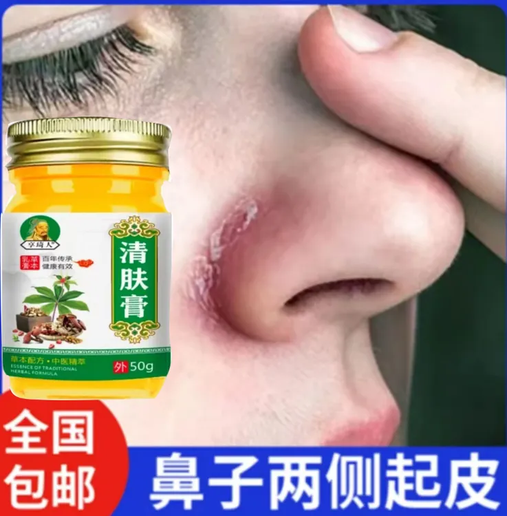 缓解鼻翼两侧发红脱皮脱屑痒皮肤干燥起皮专用清凉草本护理膏