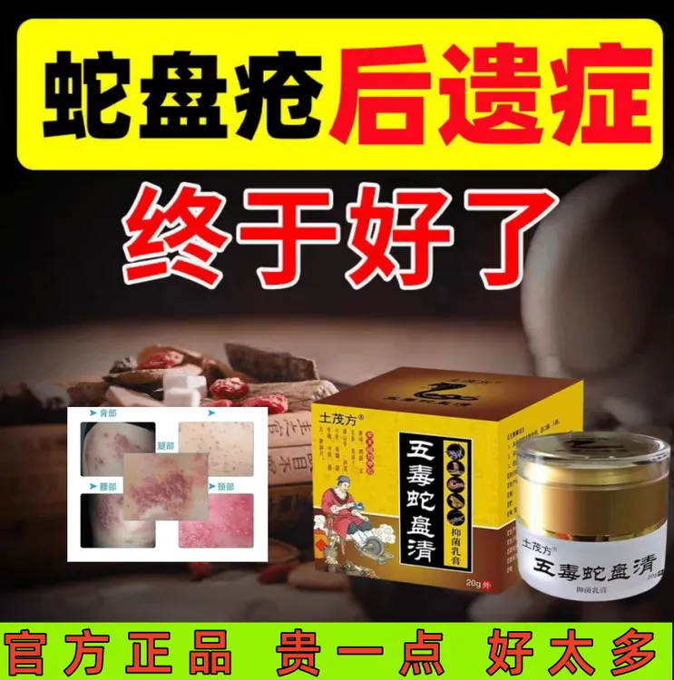带状泡疹后遗神经痛蛇盘疮膏蛇盘清宝缠蛇龙生直器泡专用外用膏
