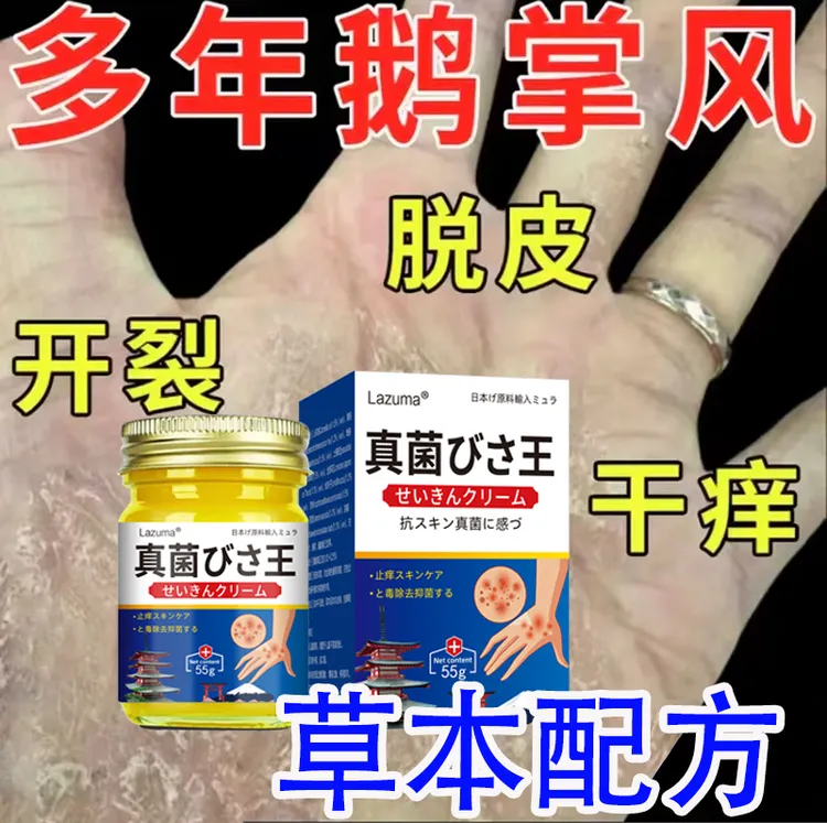 正品俄掌风手足脱皮开裂膏手痒小水苞全身可以抑菌外用涂抹舒适膏