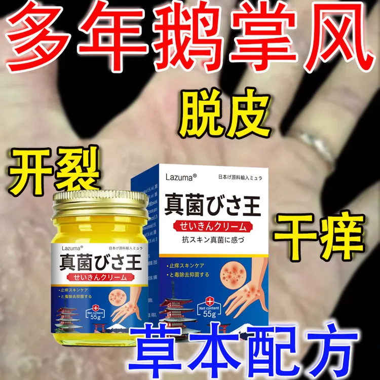 【真菌王】手足干裂脱皮克星草本抑菌膏四季修护神器抑菌止痒涂抹膏