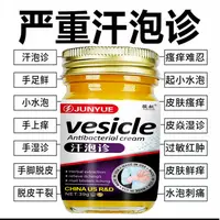 美国汗泡诊手上起小水泡脱皮抑菌手指缝痒干裂草本萃取乳膏