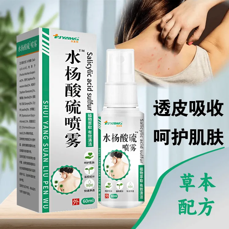 水杨酸硫喷雾前胸后背抑菌喷雾抑菌止痒小水泡温和舒缓草本配方