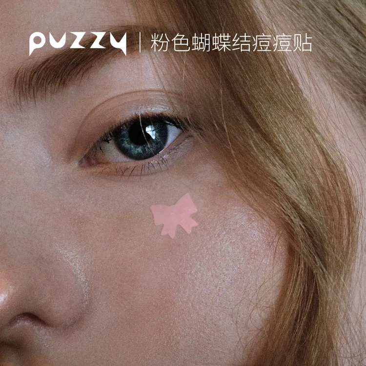 Puzzy粉色蝴蝶结痘痘贴可爱甜酷遮盖痘印可上妆32粒/盒
