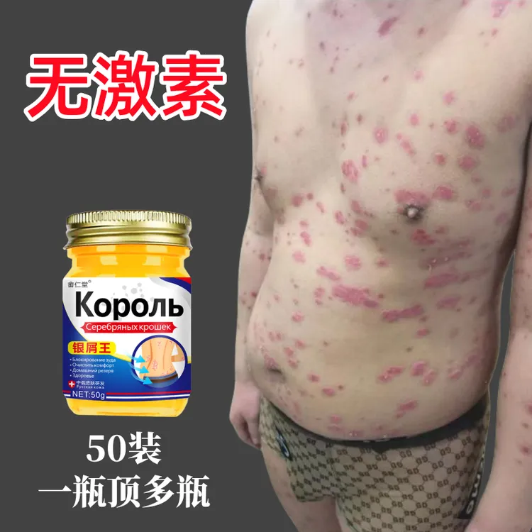 【官方正品】快速止痒专用膏除真菌王草本止痒膏皮肤痒越挠越痒免洗