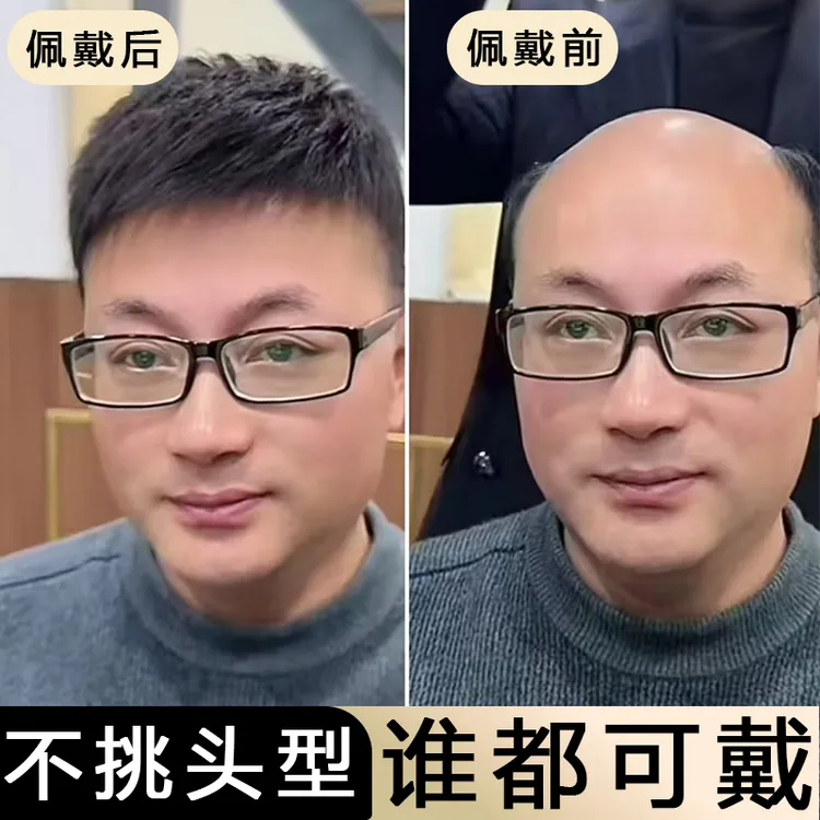 男士假发定制补发片前额头发际线刘海片头顶补发秃顶全短发真发