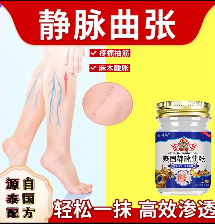 静脉曲张腿部青筋酸胀疼痛麻木凸起