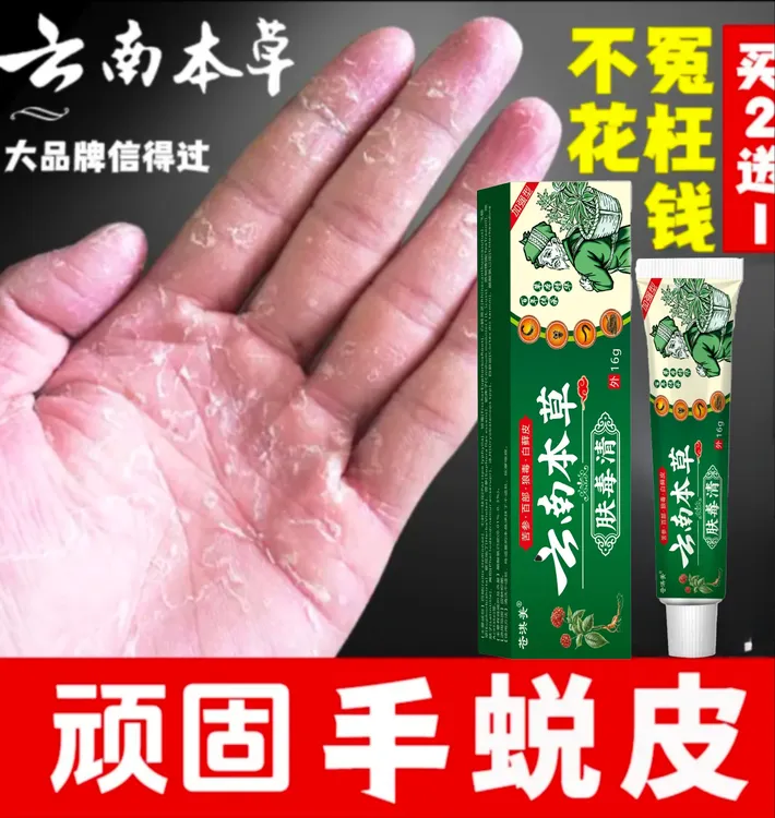 云南本草膏手足脱皮膏草本精粹外用手脚部脱皮干裂抑菌止痒干软膏