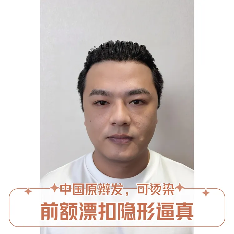 【无忌优选-云锦丝】前额漂扣超薄生物边假发钩织真头皮辫子发