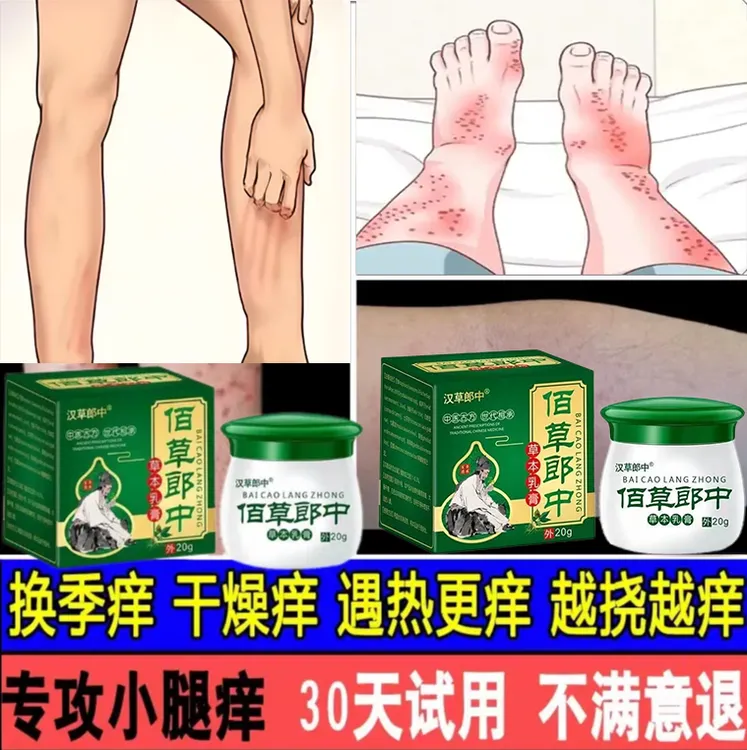 皮肤干燥型草本植物止痒