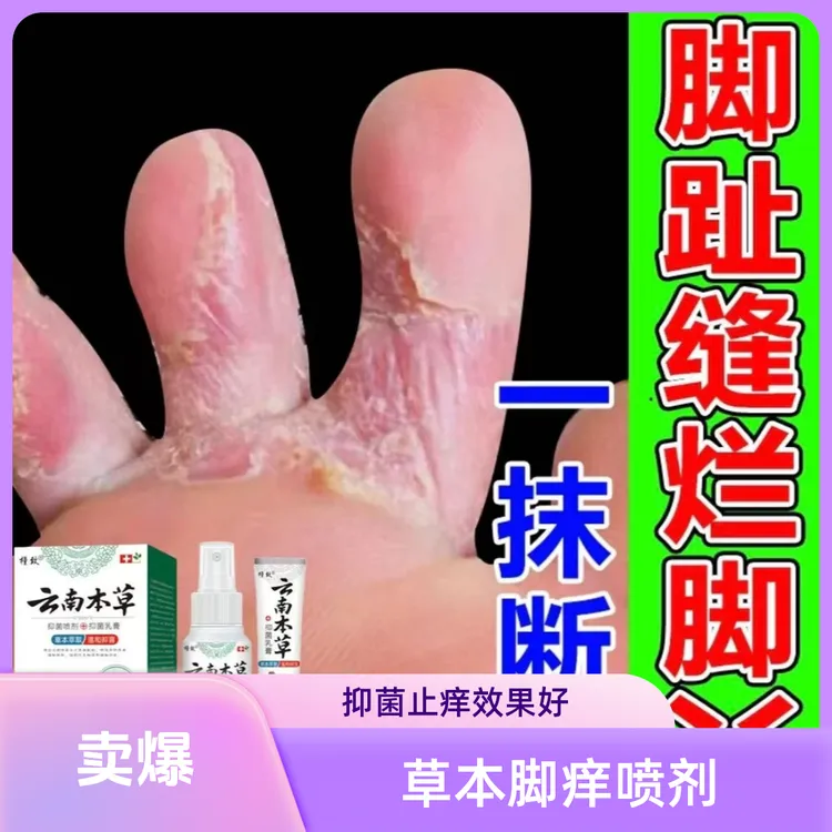 【官方正品】云南本草脚痒脚脱皮喷脚王脚臭起水泡脚汗抑菌止痒喷剂