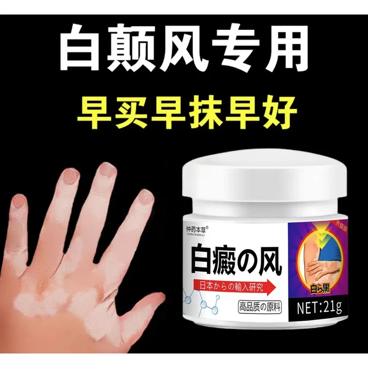 白斑净外用涂抹膏草本温和多部位可用