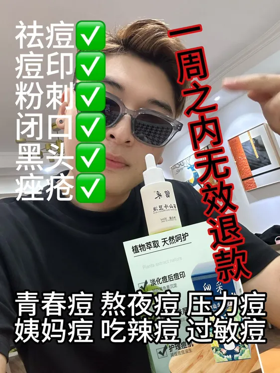  拉萨 发货留采苗山斗痘液青春痘黑头白头粉刺闭口祛痘印