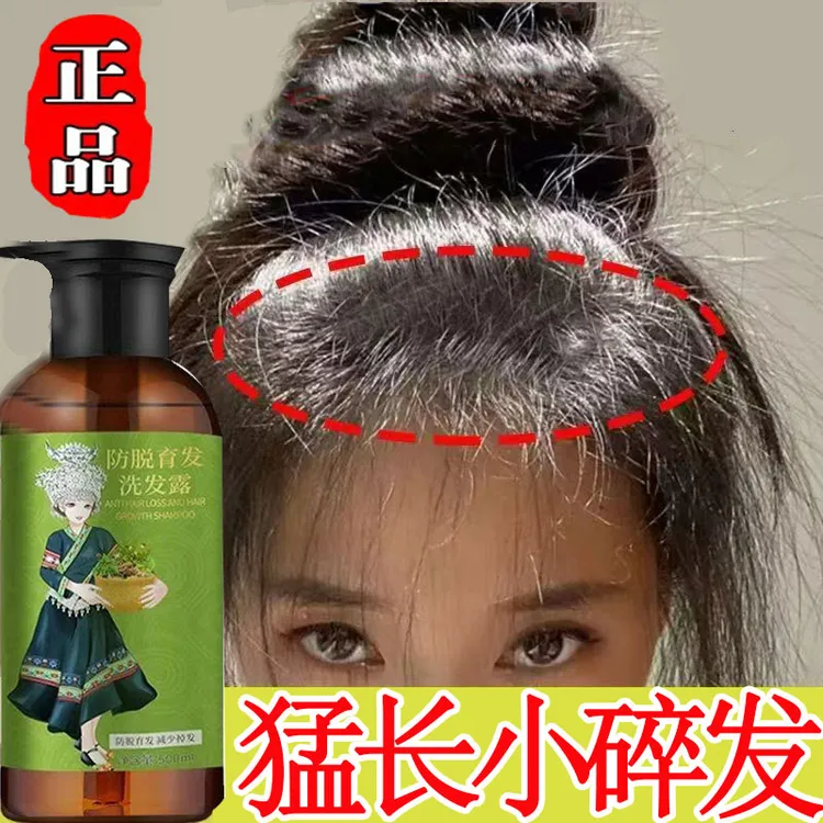 【猛涨小碎发】正品苗医堂强根发际线健发防发脱育发洗发水柔顺滋养